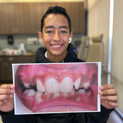 Teen Holding Braces Before & After 3